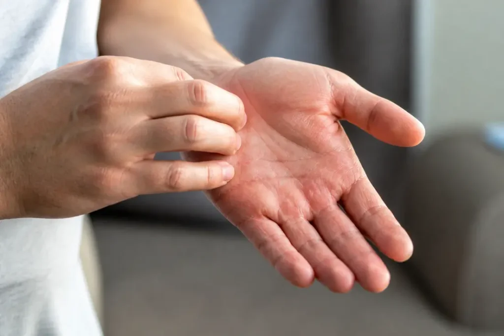 Main droite qui gratte : simple superstition ou vraie cause médicale ?