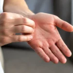 Main droite qui gratte : simple superstition ou vraie cause médicale ?